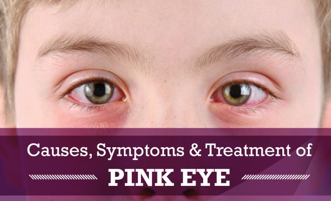 Pink Eye